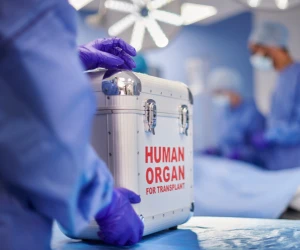 Апарати та витратні матеріали для трансплантації органів від провідних європейських виробників
