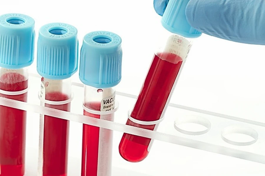 Отчет об исследовании рынка пробирок для сбора крови